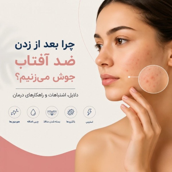 چرا بعد از زدن ضد آفتاب جوش می‌زنیم؟ دلایل، اشتباهات و راهکارهای درمان